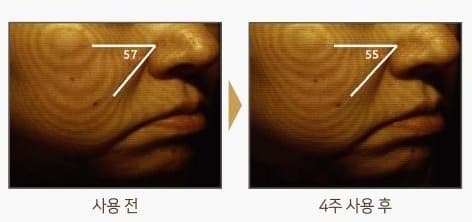 뺨 피부를 등고선으로 촬영한 사진 두 장. 사용 전 각도 표시 57, 4주 사용 후 각도 표시 55