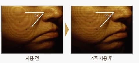뺨 피부를 등고선으로 촬영한 사진 두 장. 사용 전 각도 표시 57, 4주 사용 후 각도 표시 55
