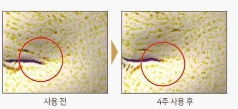 눈가 피부 표면을 촬영한 사진 두 장. 사용 전과 4주 사용 후, 빨간 원으로 주름 부위 표시