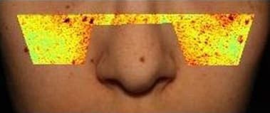 사용 전 — 코 아래 얼굴 사진, 좌우 볼에 겉 멜라닌 색 지도(빨강 · 노랑 · 초록)